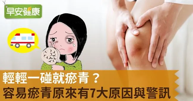 輕輕一碰就瘀青？容易瘀青原來有7大原因與警訊！