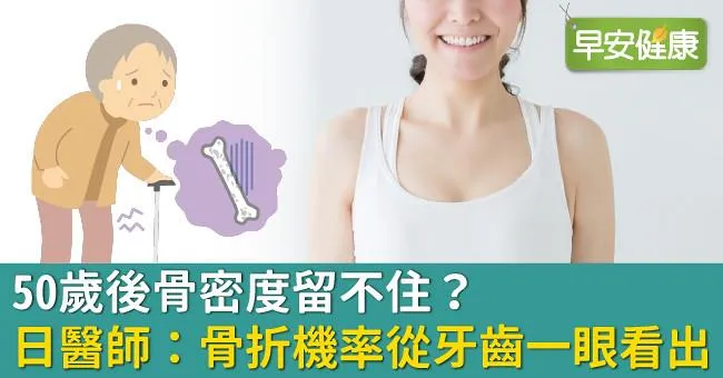 50歲後骨密度留不住？日醫師：骨折機率從牙齒一眼看出