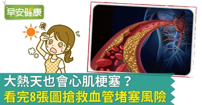 大熱天也會心肌梗塞？看完8張圖搶救血管堵塞風險！