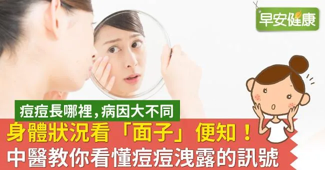 身體狀況看「面子」便知！中醫教你看懂痘痘洩露的訊號