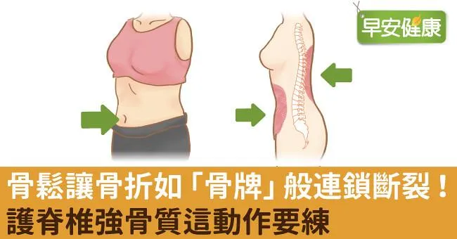 骨鬆讓骨折如「骨牌」般連鎖斷裂！護脊椎強骨質這動作要練