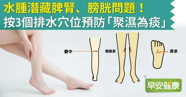 水腫潛藏脾腎、膀胱問題！按3個排水穴位預防「聚濕為痰」