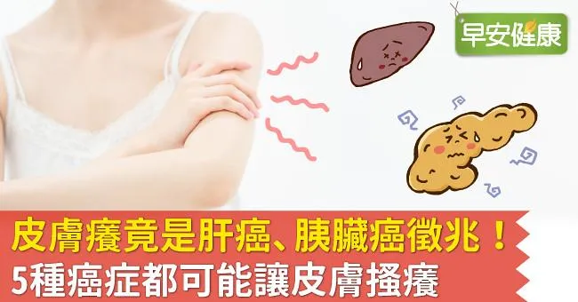 皮膚癢竟是肝癌、胰臟癌徵兆！5種癌症都可能讓皮膚搔癢