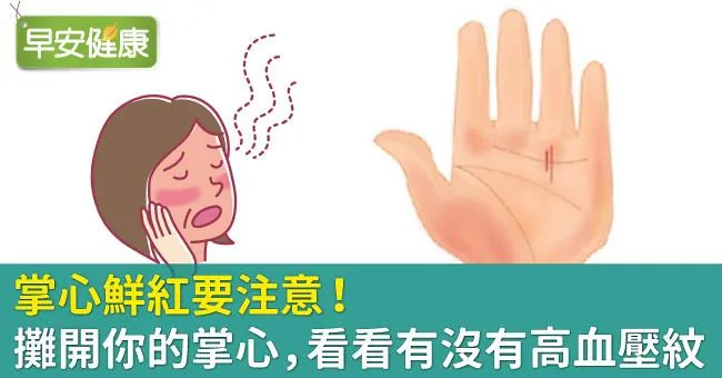 掌心鮮紅要注意！攤開你的掌心，看看有沒有高血壓紋