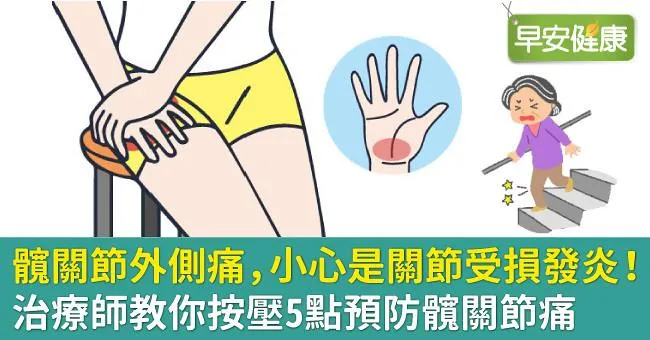 髖關節外側痛，小心是關節受損發炎！治療師教你按壓5點預防髖關節痛