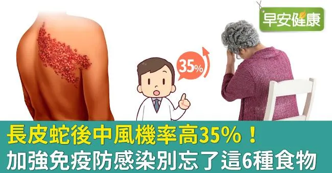 長皮蛇後中風機率高35％！加強免疫防感染別忘了這6種食物