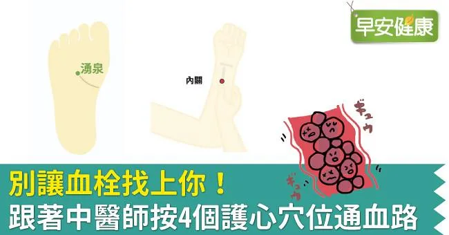 別讓血栓找上你！跟著中醫師按4個護心穴位通血路