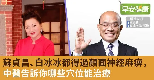 蘇貞昌、白冰冰都得過顏面神經麻痹，中醫告訴你哪些穴位能治療