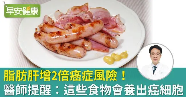 脂肪肝增2倍癌症風險！醫師提醒：這些食物會養出癌細胞