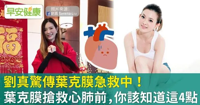 劉真驚傳葉克膜急救中！葉克膜搶救心肺前，你該知道這4點