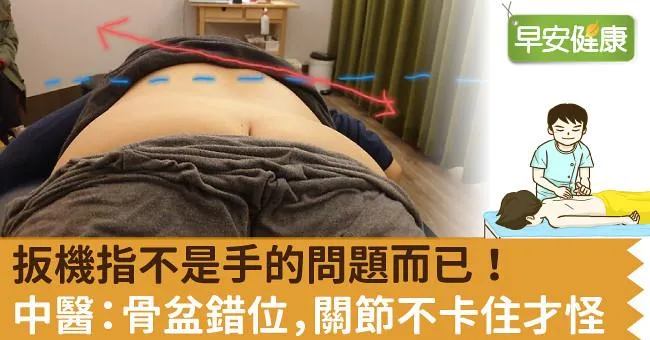 扳機指不是手的問題而已！中醫：骨盆錯位，關節不卡住才怪