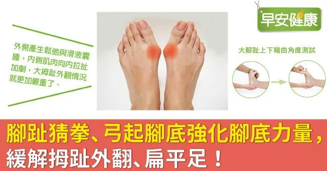 腳趾猜拳、弓起腳底強化腳底力量，緩解拇趾外翻、扁平足！
