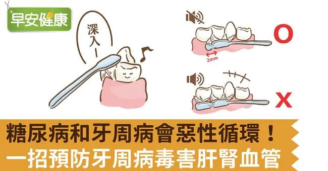 糖尿病和牙周病會惡性循環！一招預防牙周病毒害肝腎血管