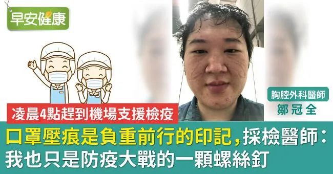 口罩壓痕是負重前行的印記，採檢醫師：我也只是防疫大戰的一顆螺絲釘