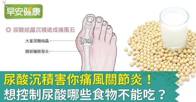 尿酸沉積害你痛風關節炎！想控制尿酸哪些食物不能吃？