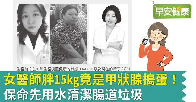 女醫師胖15kg竟是甲狀腺搗蛋！保命先用水清潔腸道垃圾