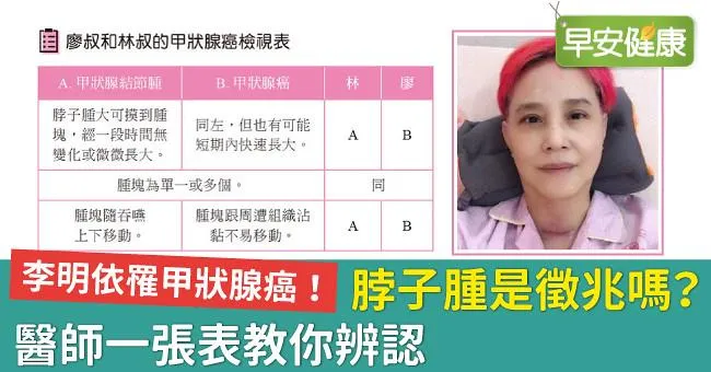 李明依罹甲狀腺癌！脖子腫是徵兆嗎？醫師一張表教你辨認