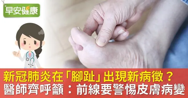 新冠肺炎在「腳趾」出現新病徵？醫師齊呼籲：前線要警惕！