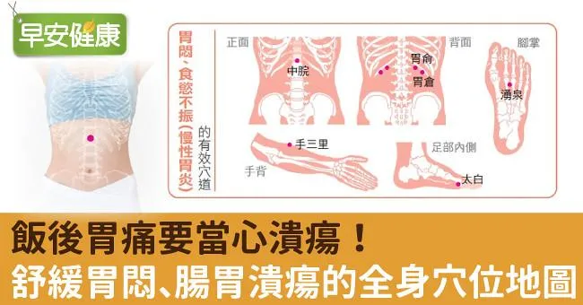 飯後胃痛要當心潰瘍！舒緩胃悶、腸胃潰瘍的全身穴位地圖