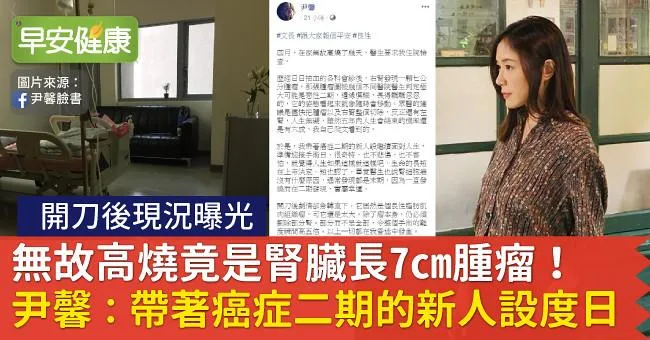 無故高燒竟是腎臟長7cm腫瘤！尹馨：帶著癌症二期的新人設度日