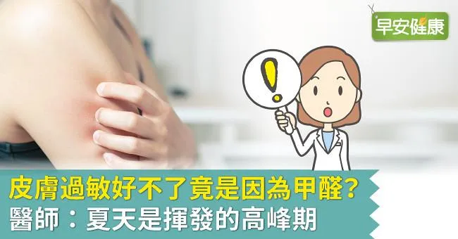 皮膚過敏好不了竟是因為甲醛？醫師：夏天是揮發的高峰期