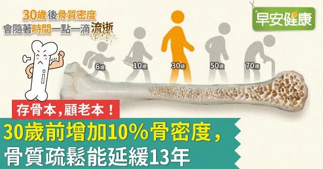 存骨本，顧老本！30歲前增加10％骨密度，骨質疏鬆能延緩13年