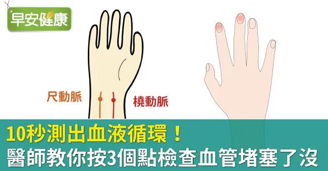 10秒測出血液循環！醫師教你按3個點檢查血管堵塞了沒