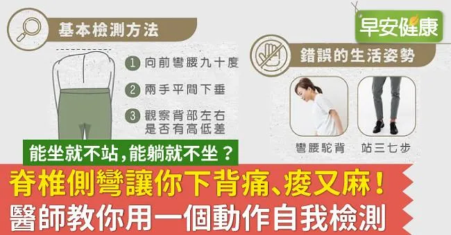 脊椎側彎讓你下背痛、痠又麻！醫師教你用一個動作自我檢測