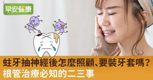 蛀牙抽神經後怎麼照顧、要裝牙套嗎？根管治療必知的二三事