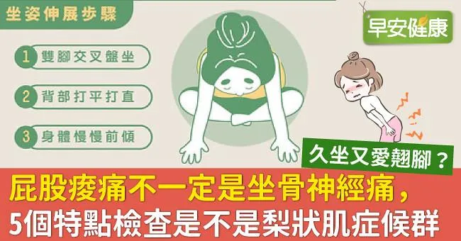 屁股痠痛不一定是坐骨神經痛，5個特點檢查是不是梨狀肌症候群