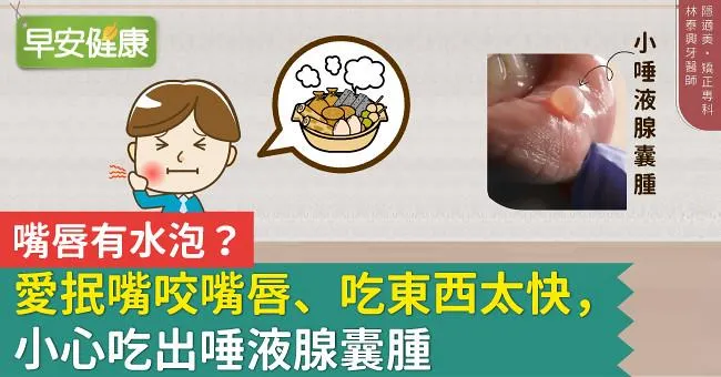 嘴唇有水泡？愛抿嘴咬嘴唇、吃東西太快，小心吃出唾液腺囊腫