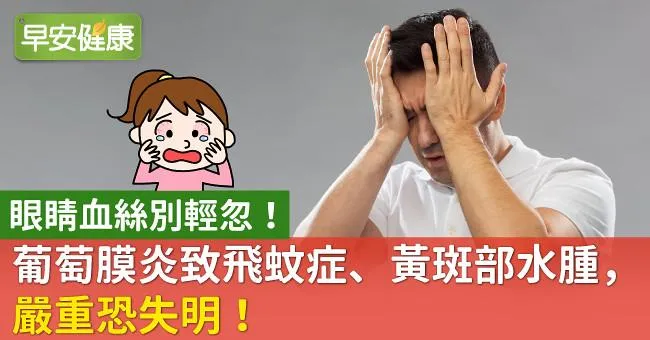 眼睛血絲別輕忽！葡萄膜炎致飛蚊症、黃斑部水腫，嚴重恐失明！