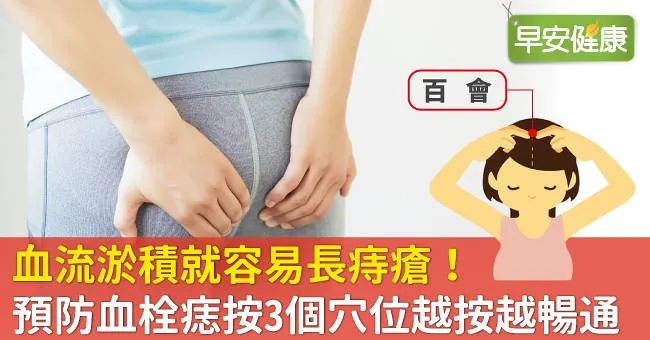 血流淤積就容易長痔瘡！預防血栓痣按3個穴位越按越暢通