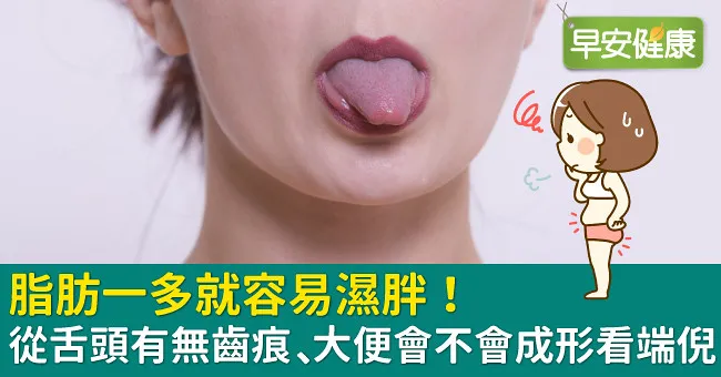 脂肪一多就容易濕胖！從舌頭有無齒痕、大便會不會成形看端倪