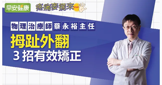 拇趾外翻怎麼辦？拇指外翻矯正3招有效｜物理治療師蔡永裕主任
