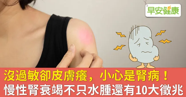 沒過敏卻皮膚癢，小心是腎病！慢性腎衰竭不只水腫還有10大徵兆