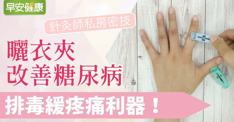 針灸師私房密技！排毒緩疼痛利器，曬衣夾改善糖尿病