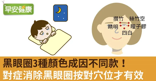黑眼圈3種顏色成因不同款！對症消除黑眼圈按對穴位才有效
