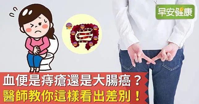 血便是痔瘡還是大腸癌？醫師教你這樣看出差別！