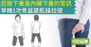 屁股下垂是內臟下垂的警訊！早晚1次骨盆底肌操拉提