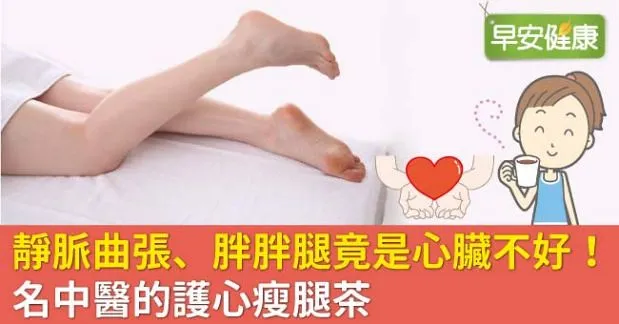 靜脈曲張、胖胖腿竟是心臟不好！名中醫的護心瘦腿茶