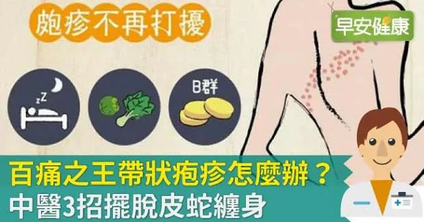 百痛之王帶狀皰疹怎麼辦？中醫3招擺脫皮蛇纏身