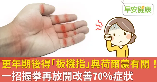 更年期後得「板機指」與荷爾蒙有關！一招握拳再放開改善70％症狀