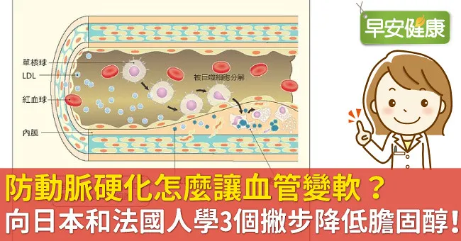 防動脈硬化怎麼讓血管變軟？向日本和法國人學3個撇步降低膽固醇！