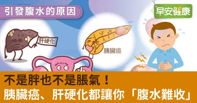 不是胖也不是脹氣！胰臟癌、肝硬化都讓你「腹水難收」