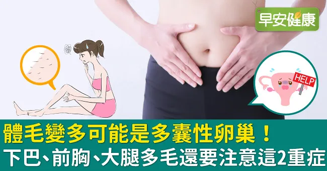體毛變多可能是多囊性卵巢！下巴、前胸、大腿多毛還要注意這2重症