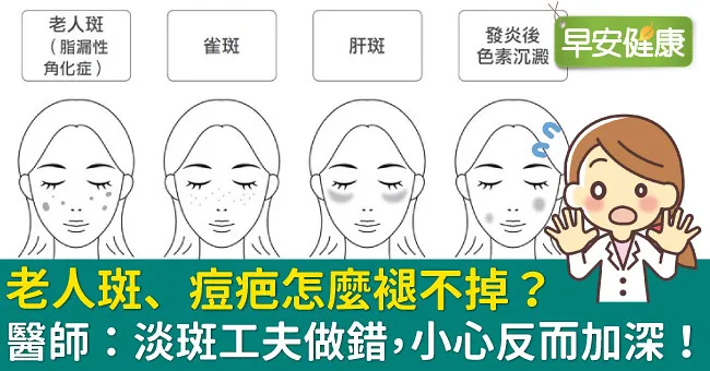 老人斑、痘疤怎麼褪不掉？醫師：淡斑工夫做錯，小心反而加深！