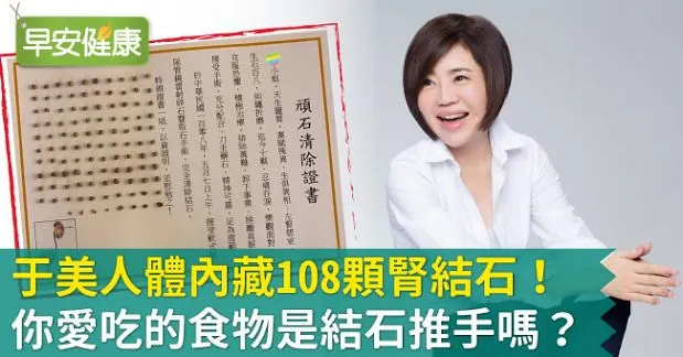 于美人體內藏108顆腎結石！你愛吃的食物是結石推手嗎？