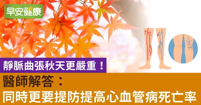 靜脈曲張秋天更嚴重！醫師解答：同時更要提防提高心血管病死亡率