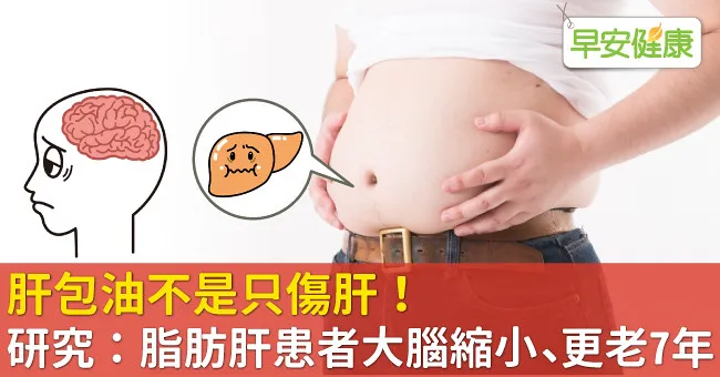 肝包油不是只傷肝！研究：脂肪肝患者大腦縮小、更老7年！